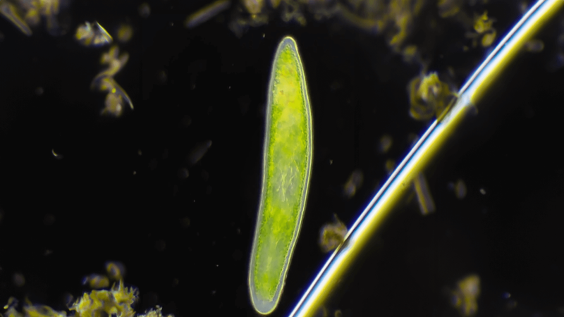 A green flatworm viewed under a microscope