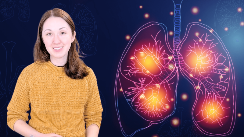 Alex Dainis with an image of a lung