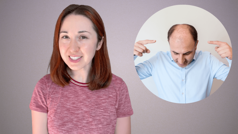 Alex Dainis with a called out image of a man pointing to his balding head.