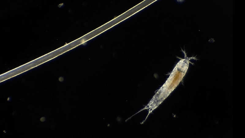 A microbe next to a hair viewed under a microscope.