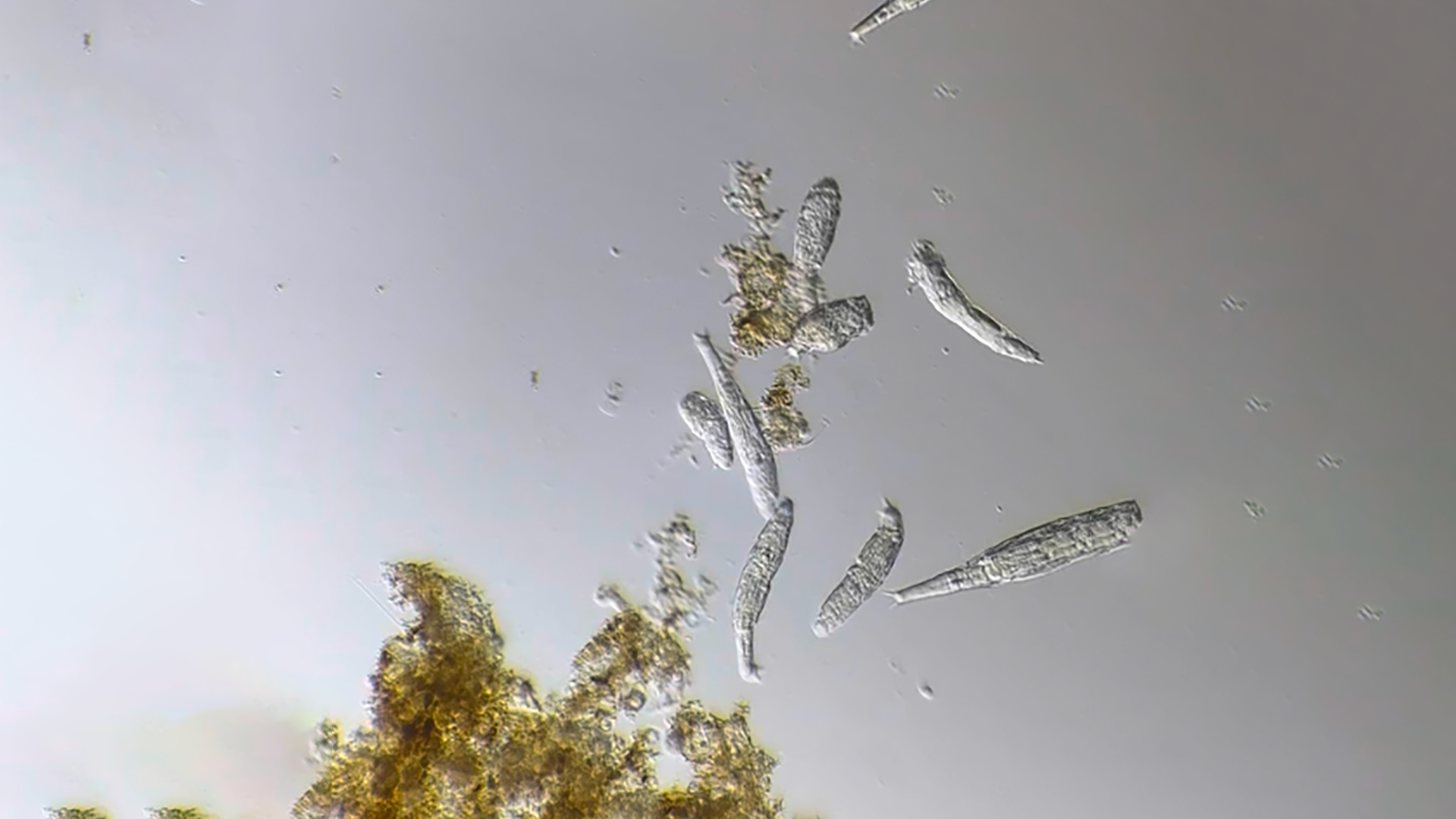 Rotifers