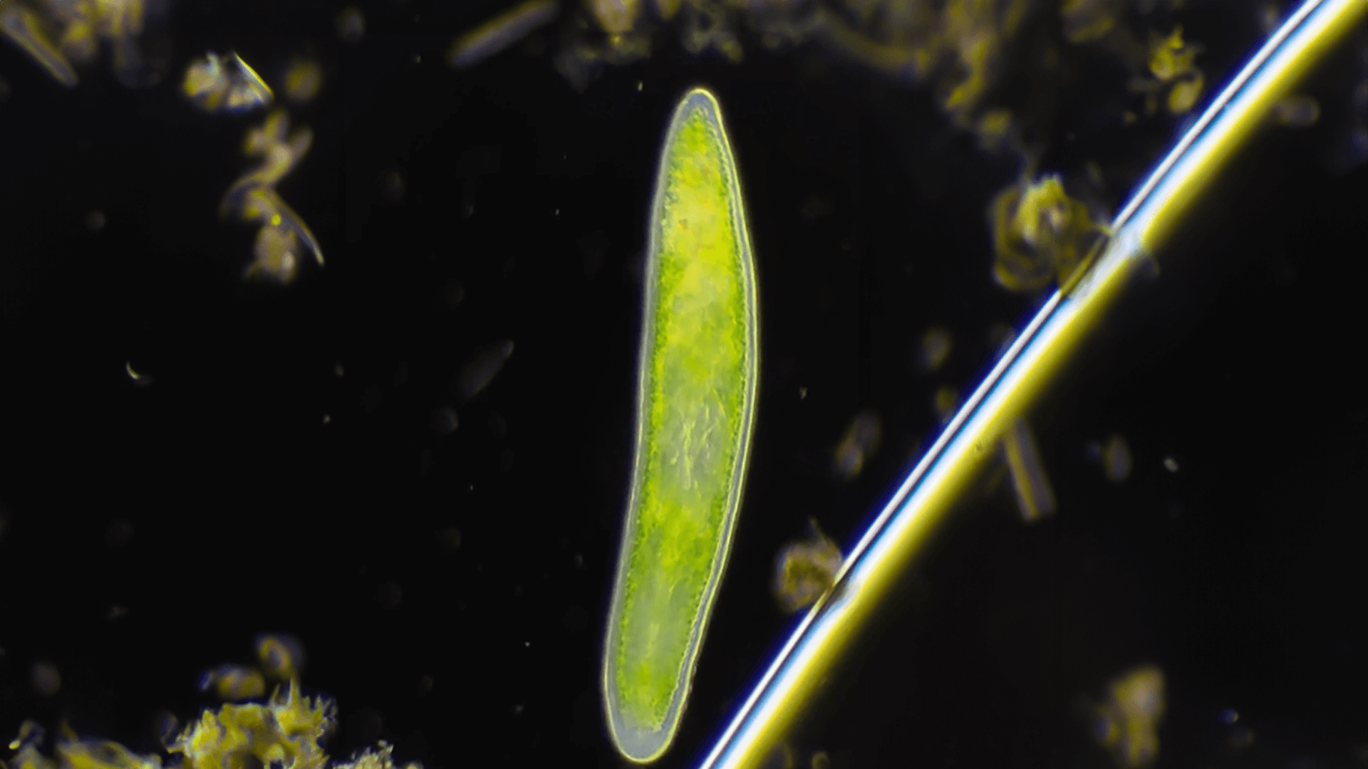 A green flatworm viewed under a microscope