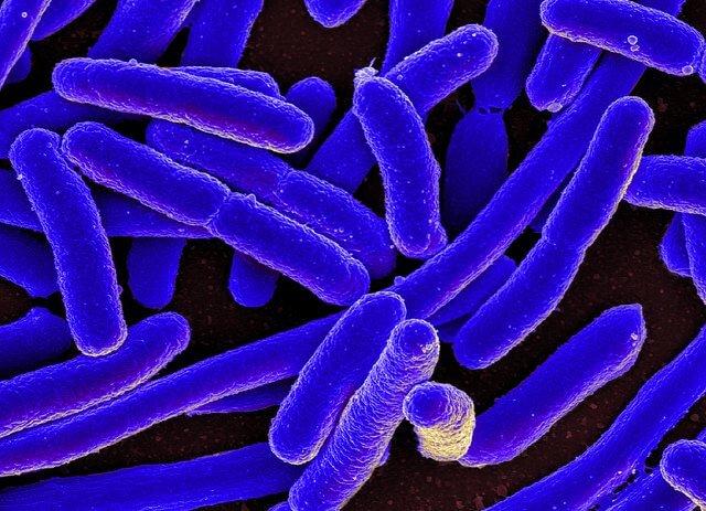 E. coli bacteria seen under a microscope. Credit: National Institute of Allergy and Infectious Diseases